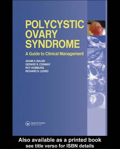 Polycystic ovary syndrome: a guide to clinical management