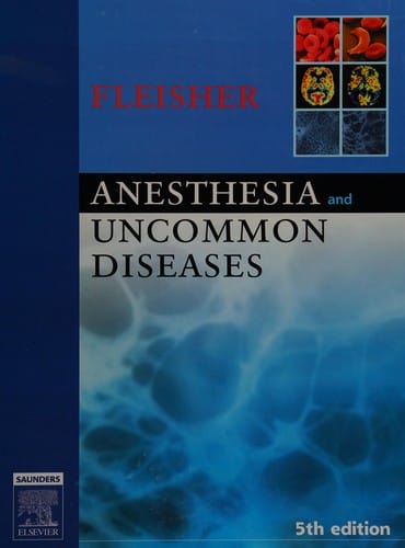 Anesthesia and uncommon diseases.