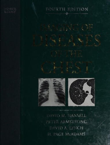 Imaging of the diseases of the chest