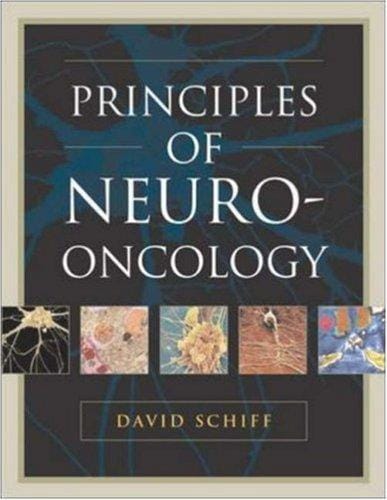 Principles and Practice of Neuro-Oncology