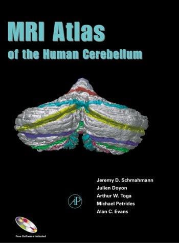 MRI Atlas of the Human Cerebellum (Book with CD-ROM for Windows & Macintosh)