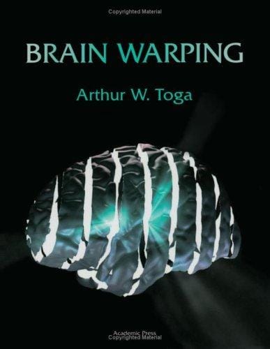 Brain Warping
