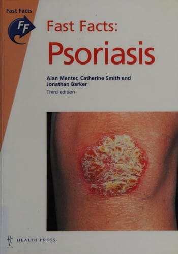 Fast Facts Parkinson's Disease (Fast Facts)