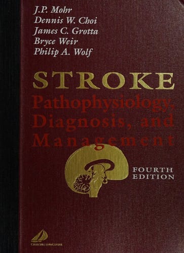 Stroke: pathophysiology, diagnosis, and management