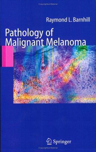 Pathology of Malignant Melanoma