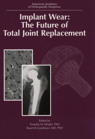 Implant Wear: The Future of Total Joint Replacement (Seminar)