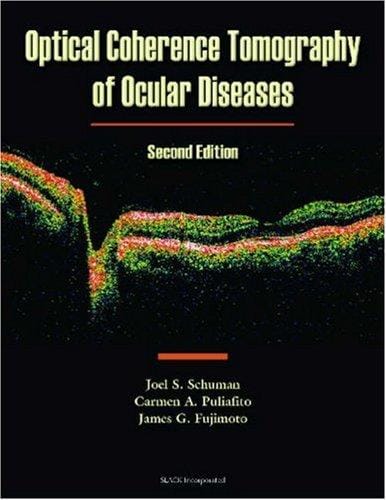 Optical Coherence Tomography of Ocular Diseases