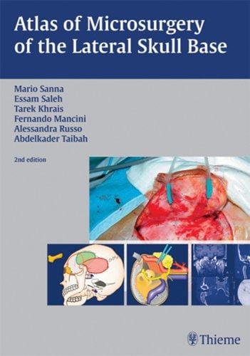 Atlas of Microsurgery of the Lateral Skull Base