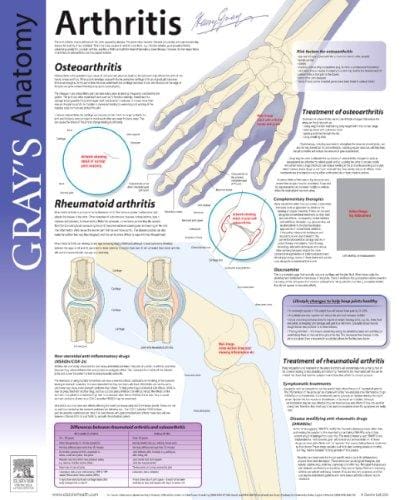 Arthritis: Gray's Anatomy Poster Series (Gray's Anatomy Poster)
