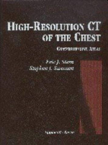High-resolution CT of the chest: comprehensive atlas