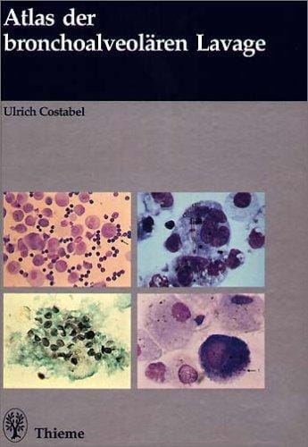 Atlas der bronchoalveolären Lavage.