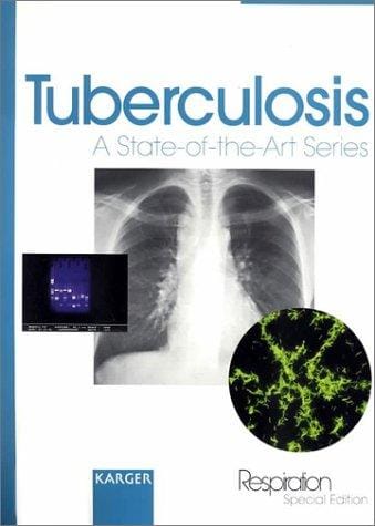 Tuberculosis (States-of-the-Art Series)