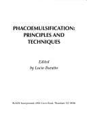 Phacoemulsification: Principles and Techniques