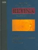 Retina