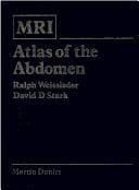 MRI atlas of the abdomen