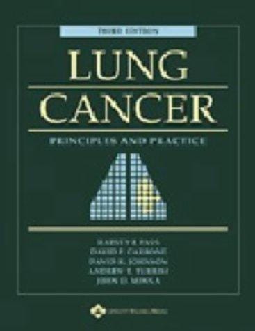 A Lung Cancer: Principles and Practice