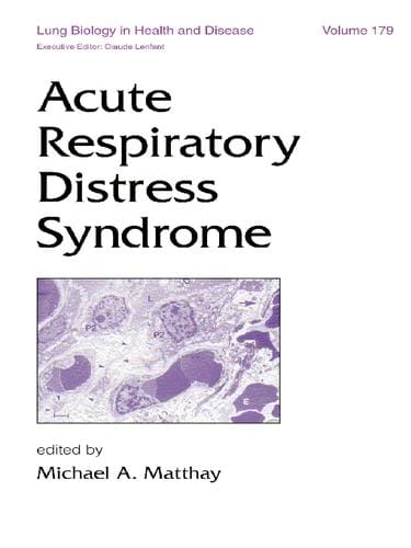Acute Respiratory Distress Syndrome