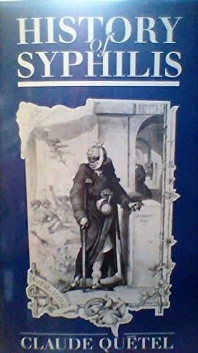 History of syphilis