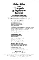 Color Atlas and Synopsis of Pigmented Lesions: The Pigmented Lesion Clinic, Massachusetts General Hospital : A Perspective of Three Decades, 1965-19