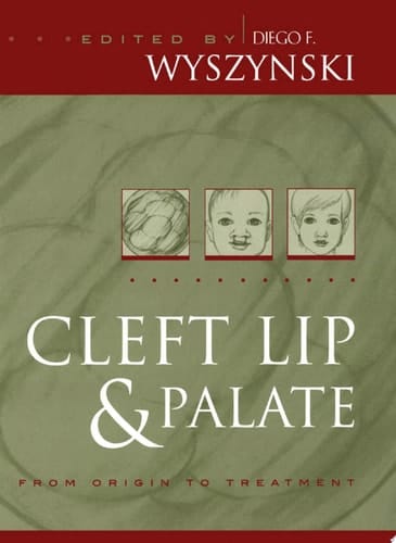 Cleft Lip and Palate: From Origin to Treatment