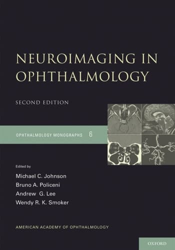 Neuroimaging in Ophthalmology (American Academy of Ophthalmology Monograph Series Book 6)