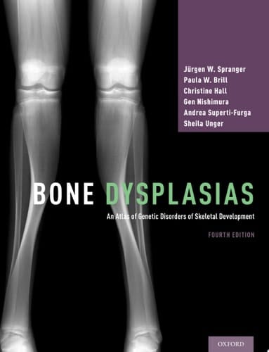 Bone Dysplasias An Atlas of Genetic Disorders of Skeletal Development