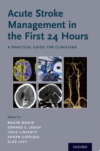 Acute Stroke Management In The First 24 Hours