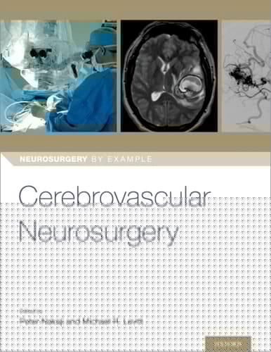 Cerebrovascular Neurosurgery (Neurosurgery by Example)