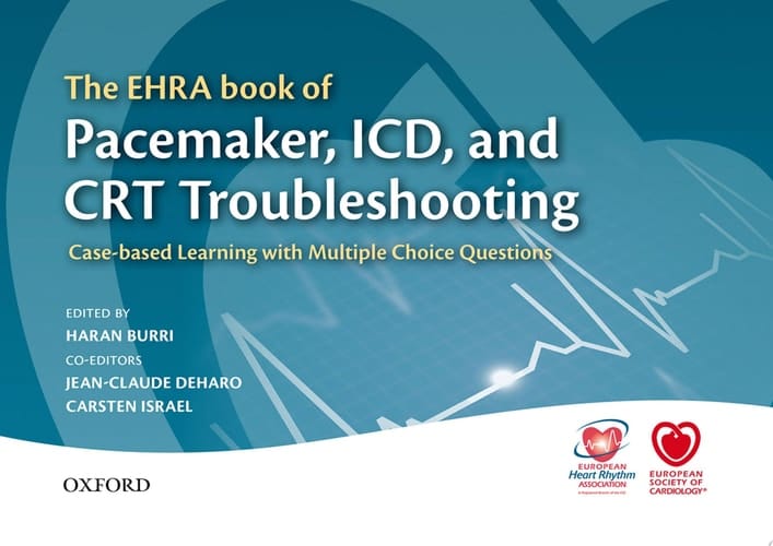 The Ehra Book Of Pacemaker, Icd, And Crt Troubleshooting