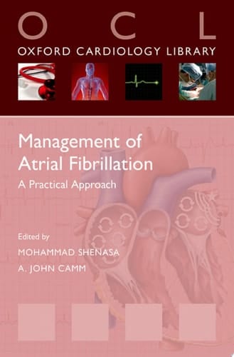 Management Of Atrial Fibrillation