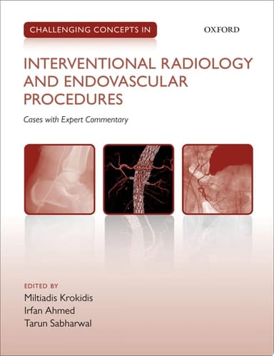 Challenging Concepts In Interventional Radiology