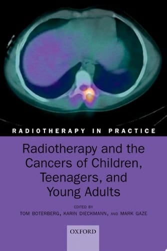 Radiotherapy And The Cancers Of Children, Teenagers, And Young Adults