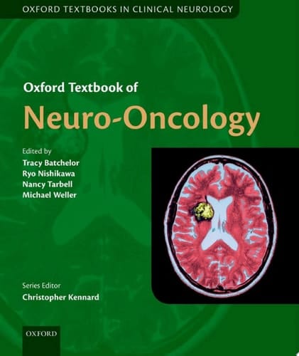 Oxford Textbook of Neuro-Oncology (Oxford Textbooks in Clinical Neurology)