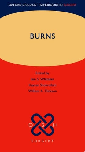 Burns (Oxford Specialist Handbooks in Surgery)