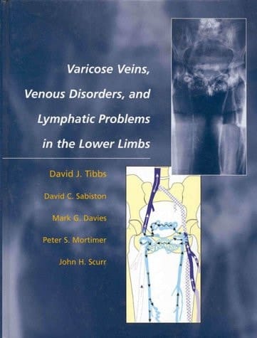 Varicose Veins, Venous Disorders, and Lymphatic Problems in the Lower Limbs