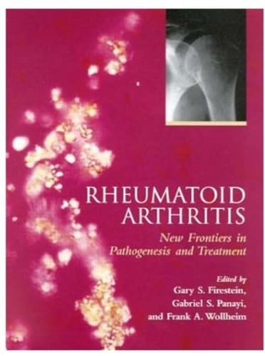 Rheumatoid Arthritis: Frontiers in Pathogenesis and Treatment