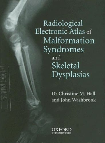 Radiological Atlas of Malformation Syndromes and Skeletal Dysplasias