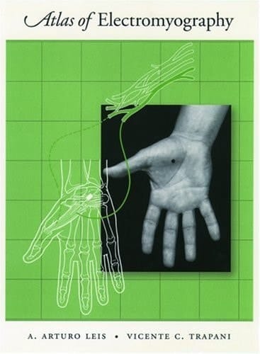 Atlas of Electromyography