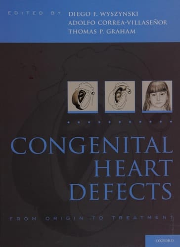 Congenital Heart Defects: From Origin to Treatment