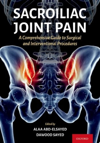 Sacroiliac Joint Pain: A Comprehensive Guide to Interventional and Surgical Procedures