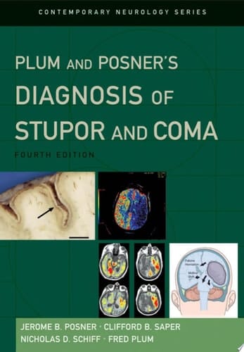 Plum And Posner's Diagnosis Of Stupor And Coma