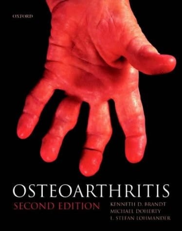 Osteoarthritis (Oxford Medical Publications)