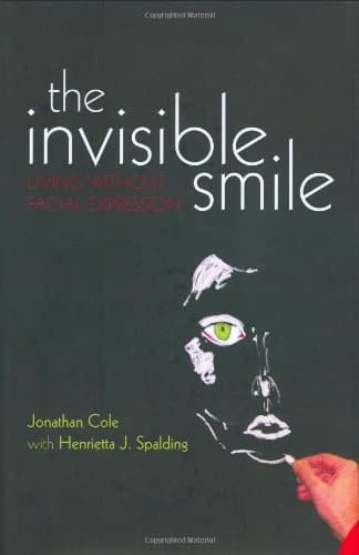 The Invisible Smile: Living Without Facial Expression