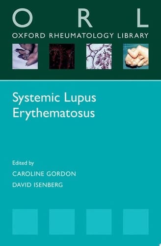 Systemic Lupus Erythematosus (Oxford Rheumatology Library)