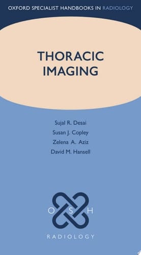 Thoracic Imaging (Oxford Specialist Handbooks in Radiology)