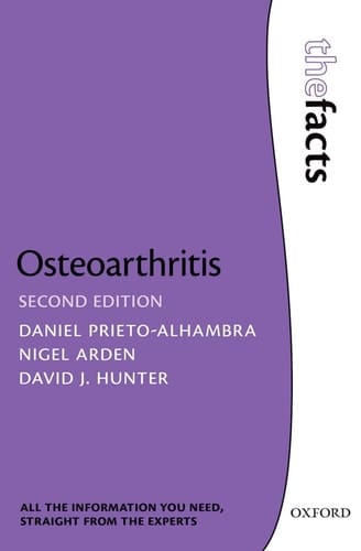 Osteoarthritis: The Facts (The Facts Series)