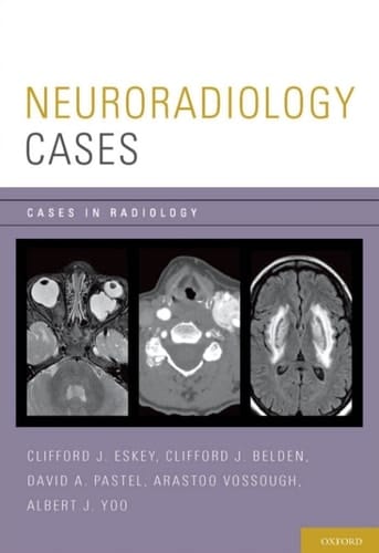 Neuroradiology Cases (Cases in Radiology)