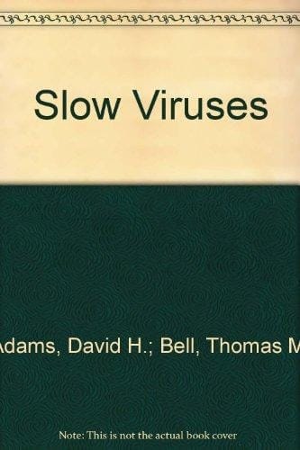 Slow Viruses