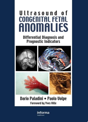 Ultrasound of Congenital Fetal Anomalies