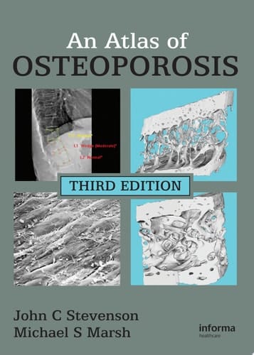 An Atlas of Osteoporosis (Encyclopedia of Visual Medicine)